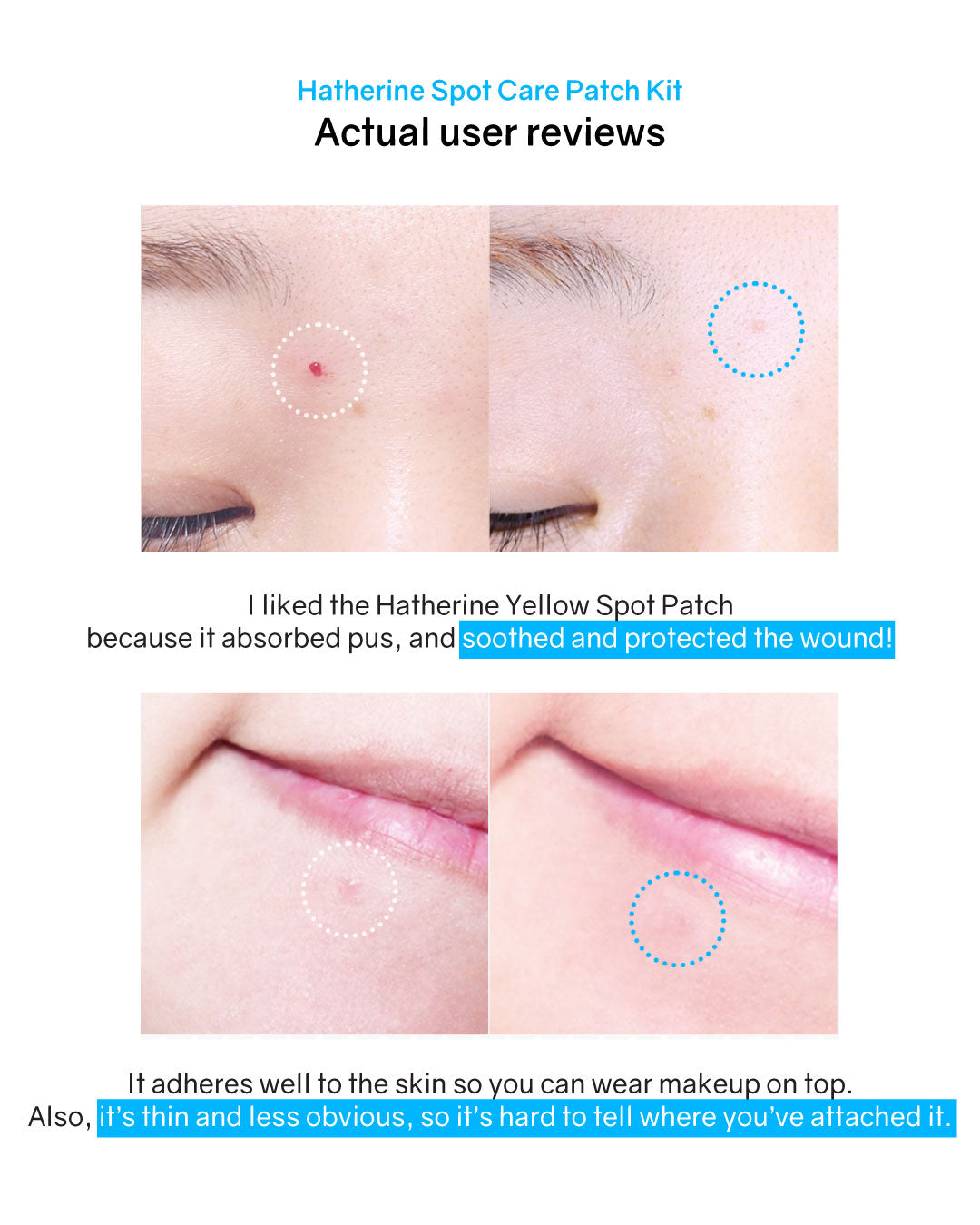 Hatherine Spot Care Patch Kit (76 patches)