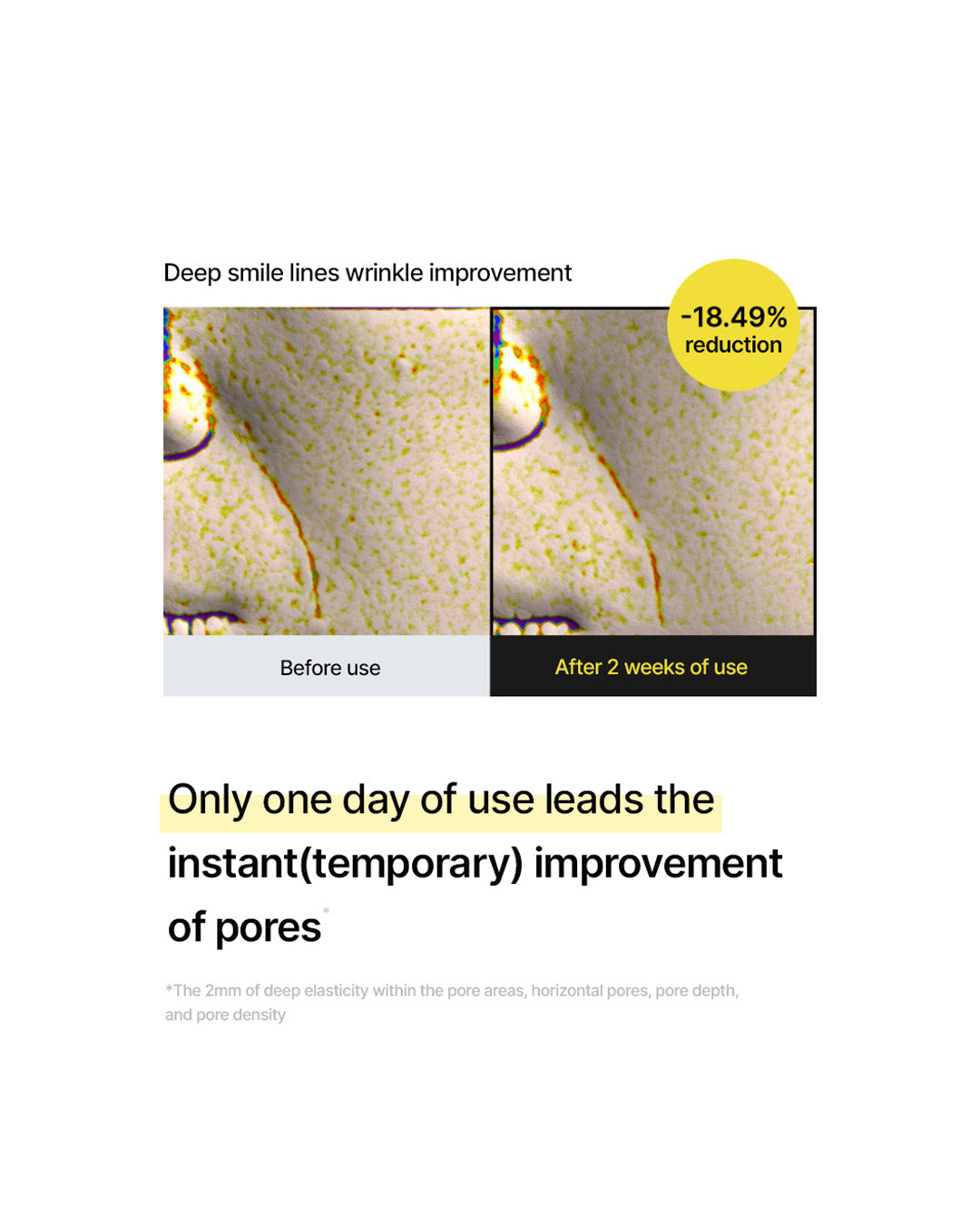 celimax the Vita-A Retinal Shot Tightening Booster