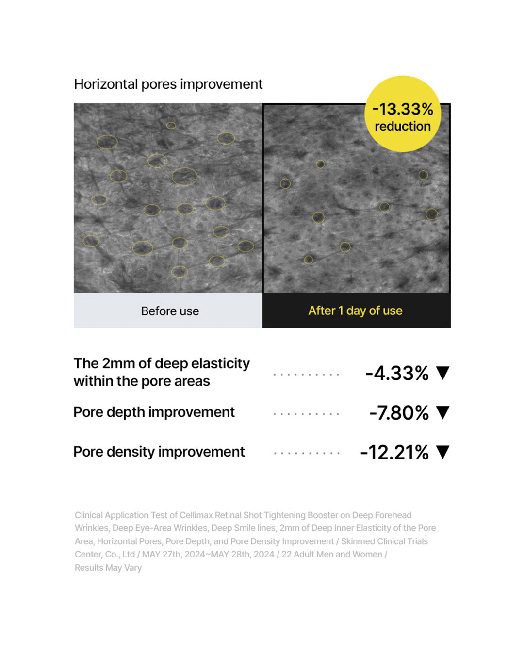 celimax the Vita-A Retinal Shot Tightening Booster