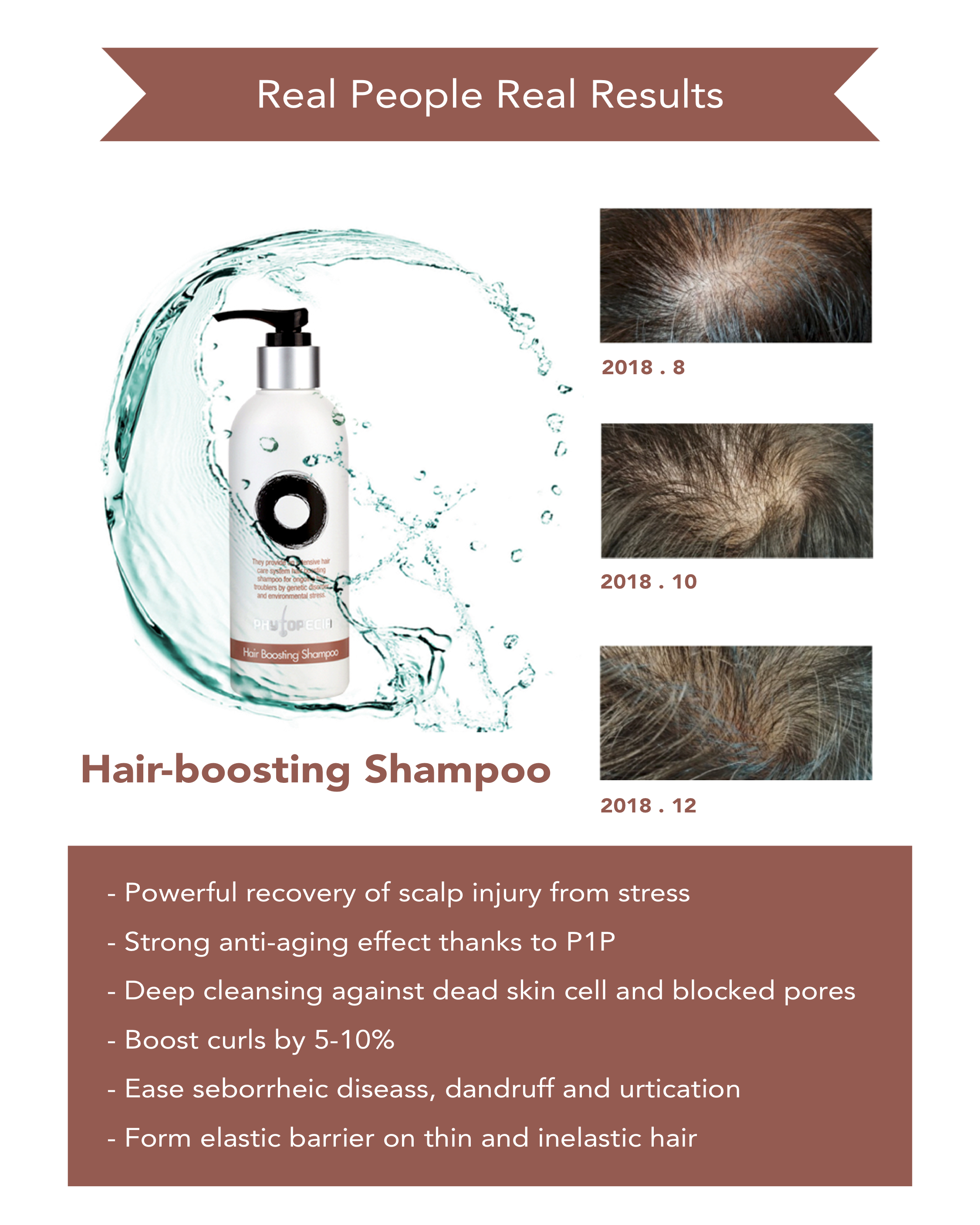 How to reverse hair loss?  Find out what we recommend!