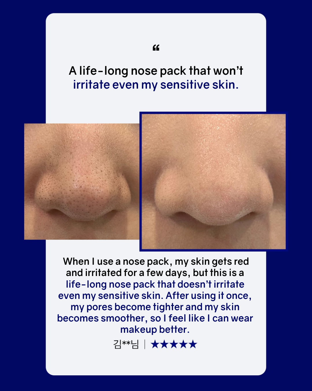 [PROMO] MEDIHEAL Black Head Melting Clear Nose Patch