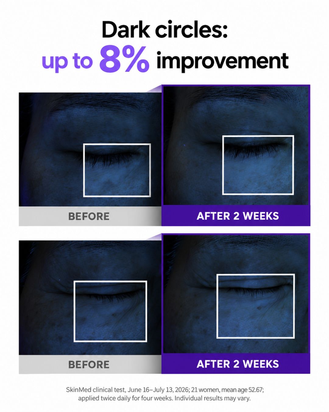 [PROMO] Lavien Volumizing Eye Lifting Cream