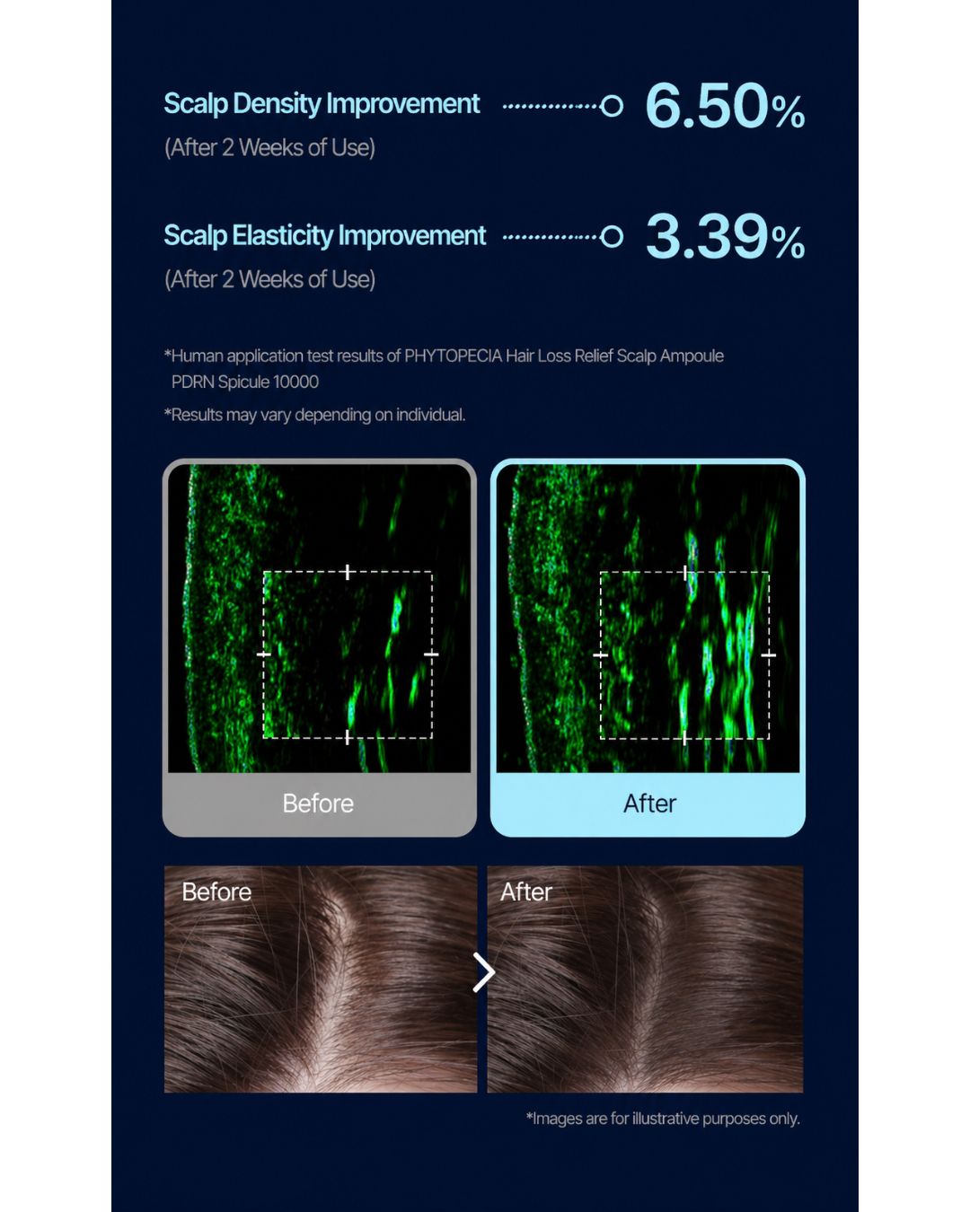 [PREORDER] Phytopecia PDRN Spicule 10000 Scalp Ampoule (15ml) (Dispatch Dates: 13-17 July)