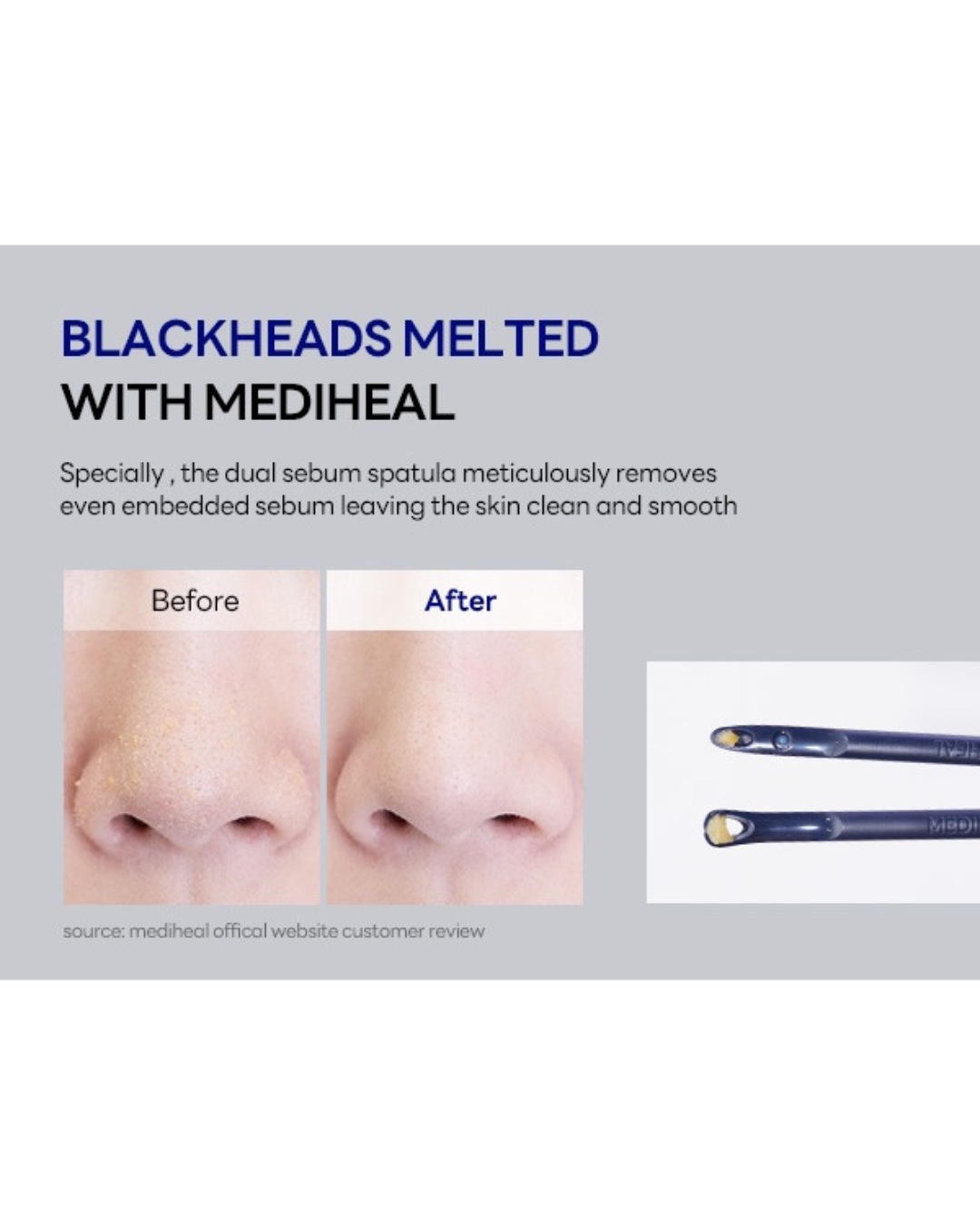 [PROMO] MEDIHEAL Black Head Melting Clear Nose Patch