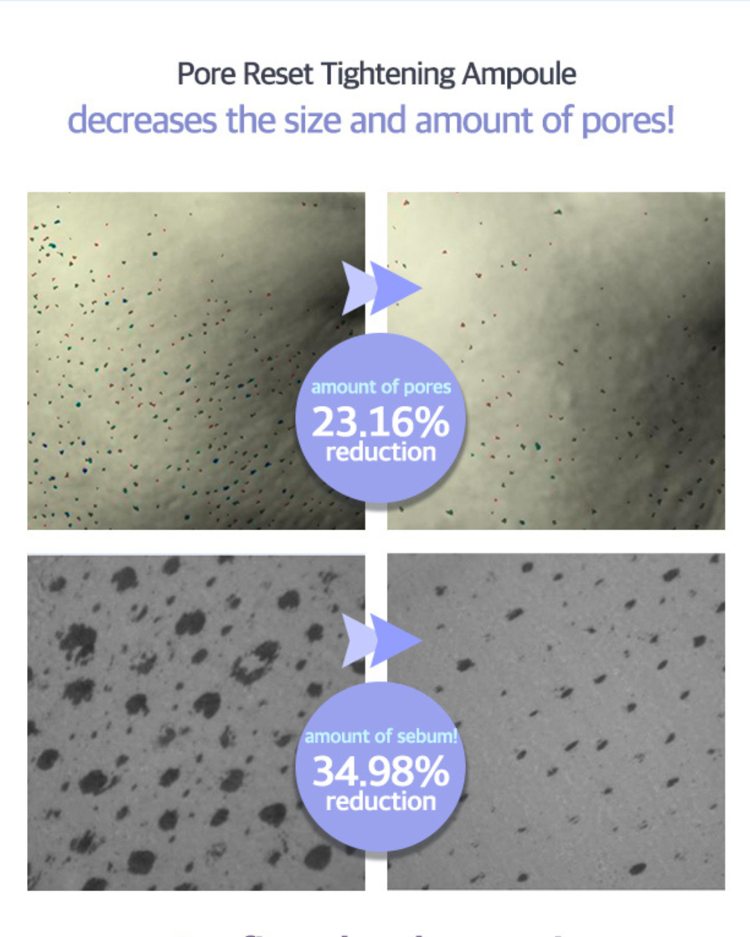 [PROMO] Luvum Pore Reset Tightening Ampoule