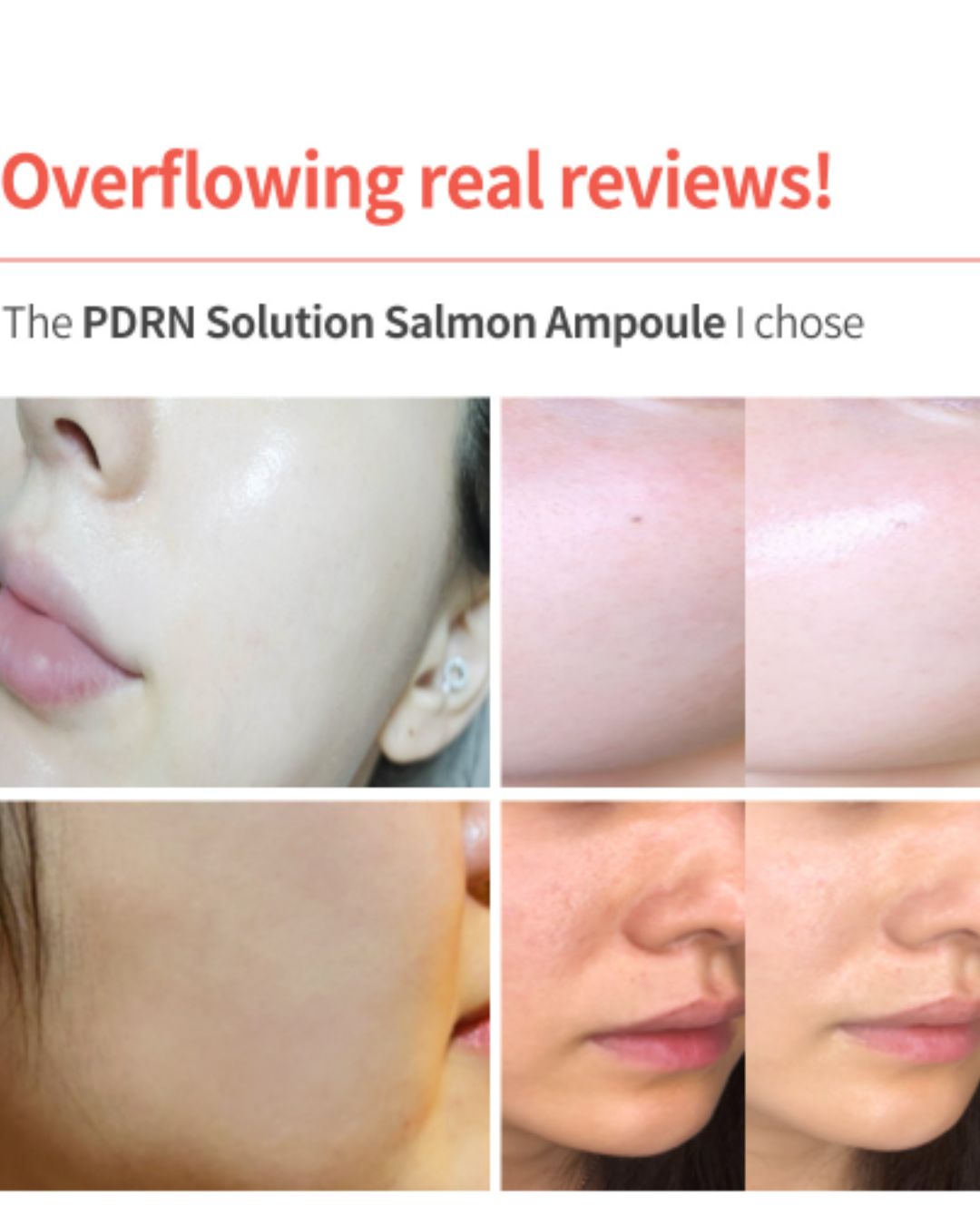 [PROMO] Dermaline PDRN Solution Salmon Ampoule