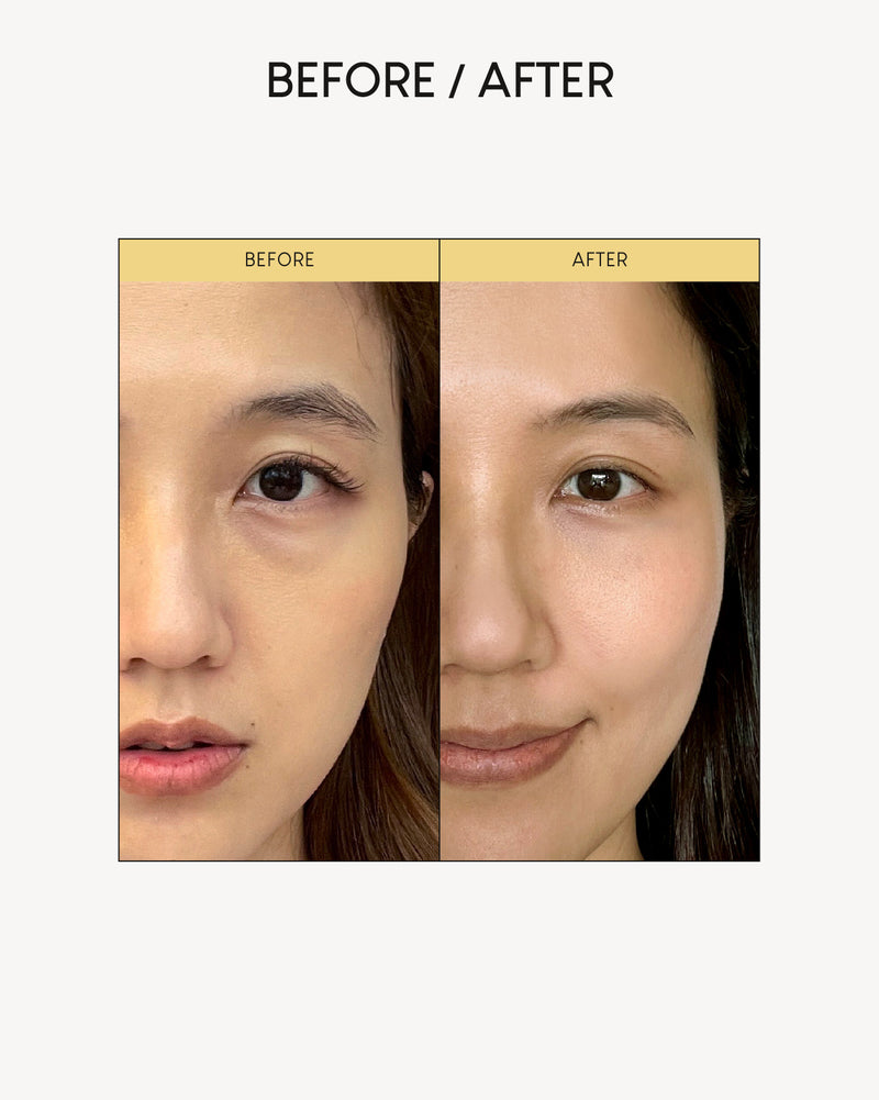 Jung Beauty Firming Microdart Eye Patch with Bakuchiol, Niacinamide and Peptides