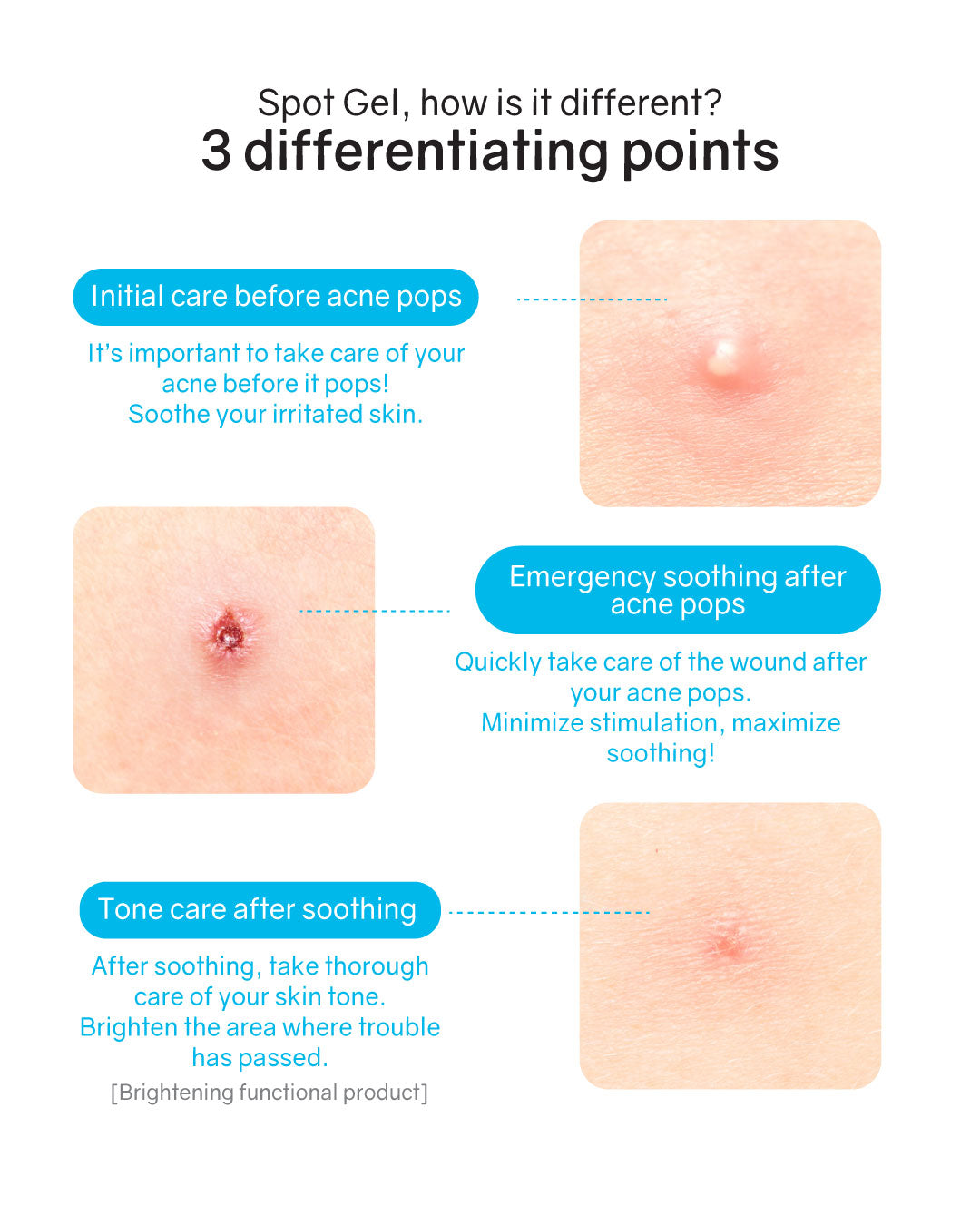 Hatherine Spot Care Clear Gel