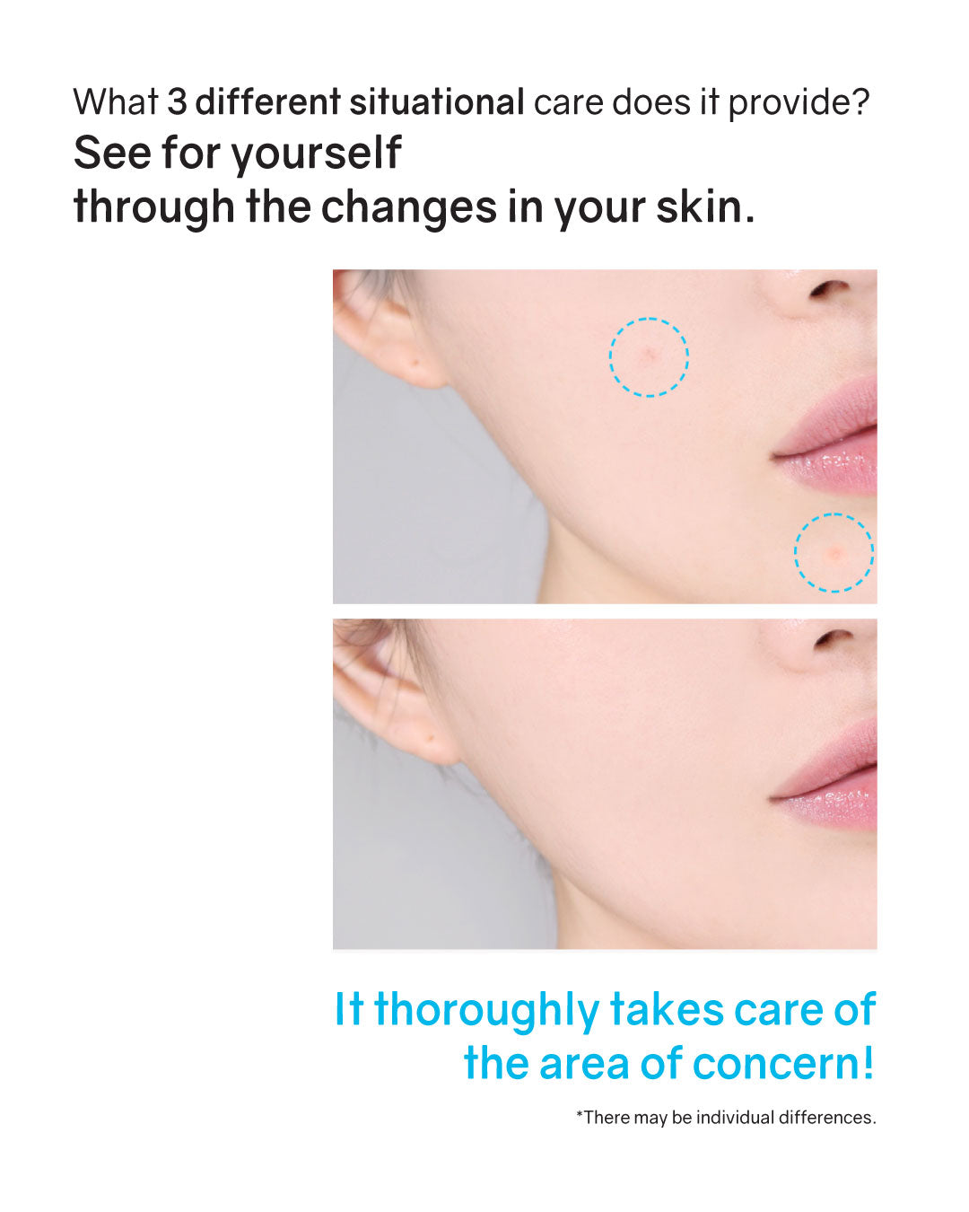 Hatherine Spot Care Clear Gel