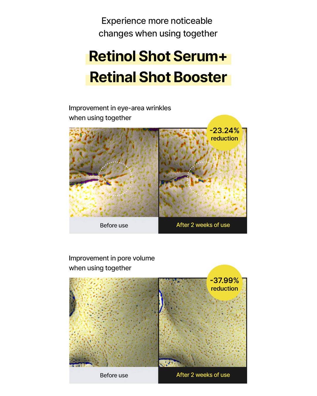 celimax the Vita-A Retinal Shot Tightening Booster