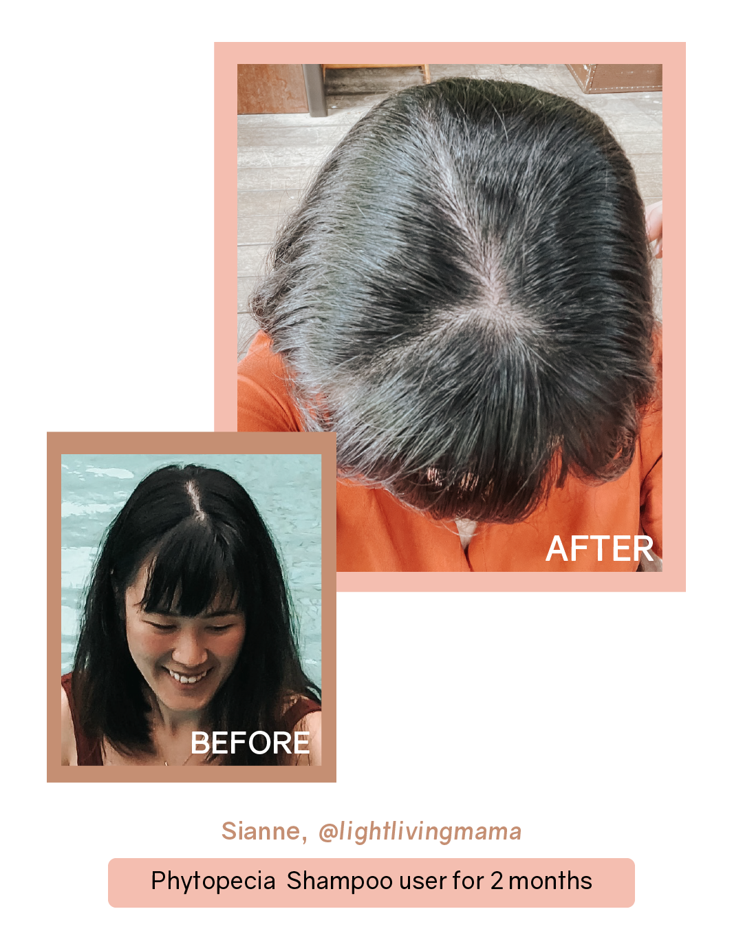 [PROMO] Phytopecia+ Hair Boosting Shampoo / Hair Tonic / Scalp Essence