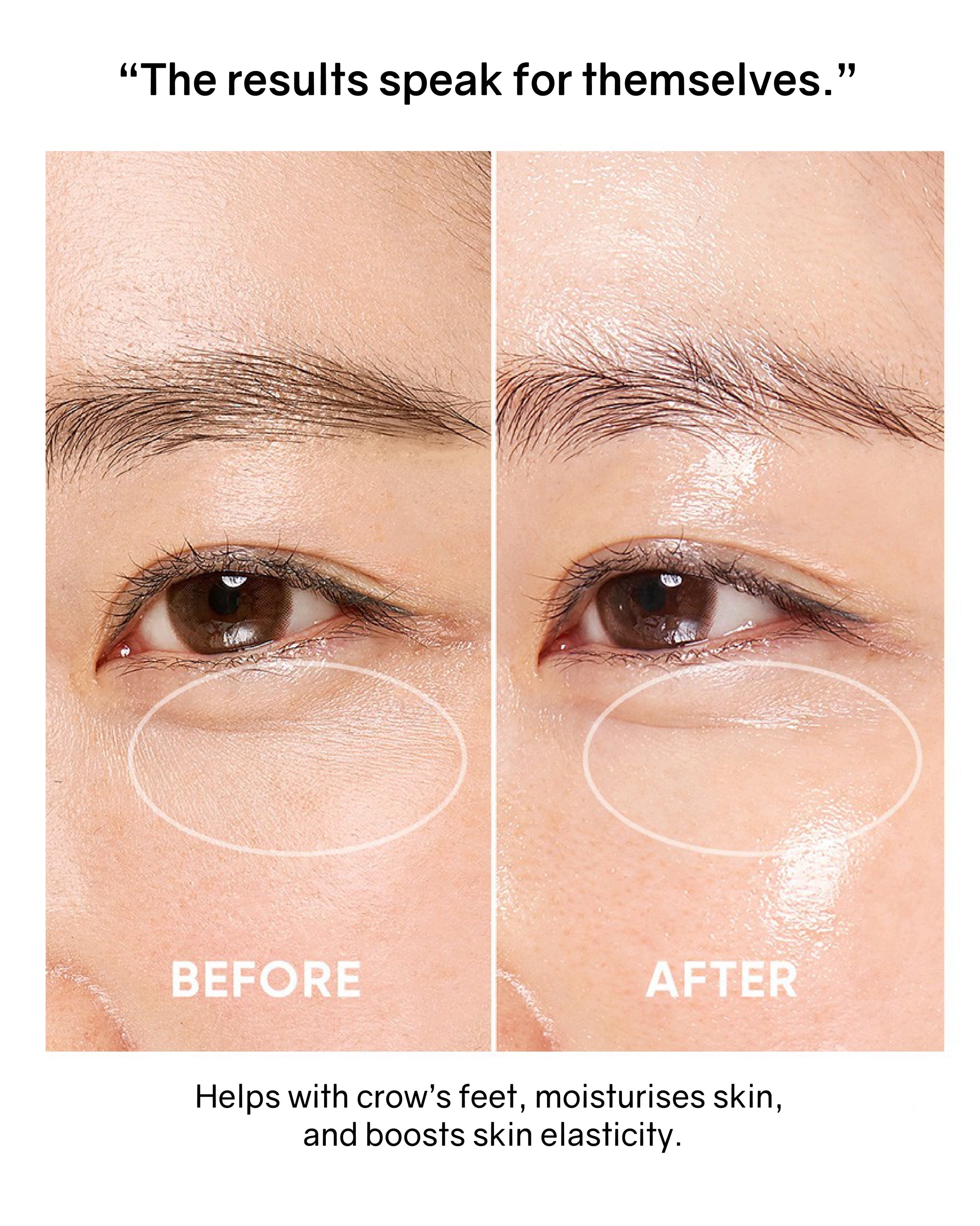 [Online Exclusive] OHIOHOO Pro Collagen Lift Kit