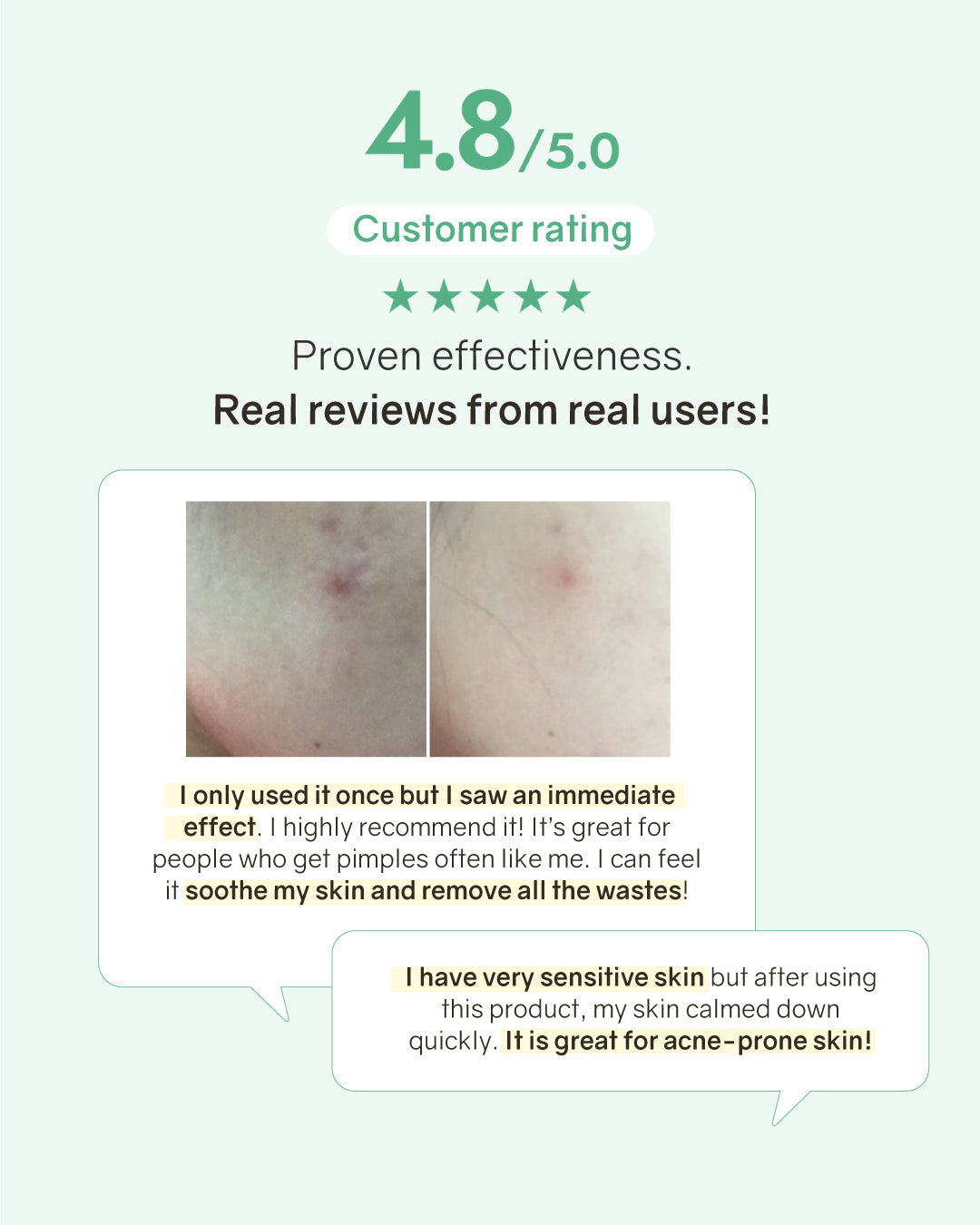 [Online Exclusive] Bonabella Teatree Purifying Mask